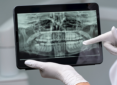 Digital dental X ray