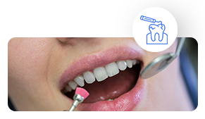 https://globaldental.pk/wp-content/uploads/2025/09/Scaling-Polishing.png