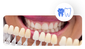 Teeth-Whitening https://globaldental.pk/wp-content/uploads/2025/09/Teeth-Whitening.png