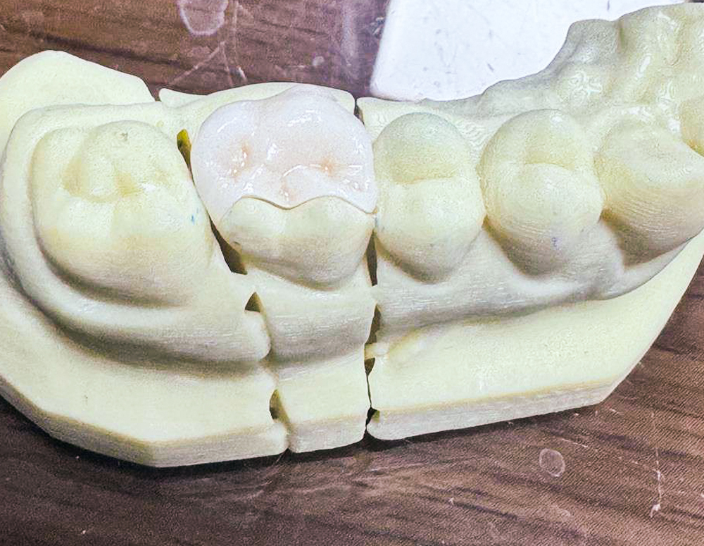 Why-Choose-Global-Dental-Laboratory https://globaldental.pk/wp-content/uploads/2025/09/Why-Choose-Global-Dental-Laboratory-10.jpg